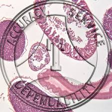 Prepared Microscope Slide of Ancylostoma Duodenale Female_main