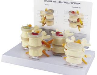 Full Size Two-Piece Vertebrae Model Set of 4_main