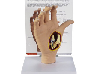 Full Size Hand Model with Osteoarthritis View_main