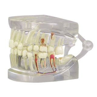 Full Size Hinged Clear Jaw Dental Model_main