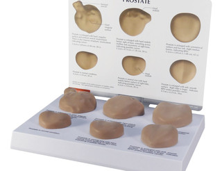 Six Full-Size Prostate Condition Anatomical Models Set_main