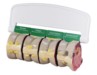 Four-Piece Human Colon Cross Section Model_main