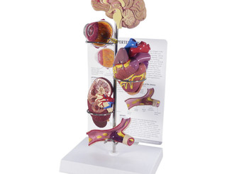 Hypertension Anatomy Model Set with Organs_main