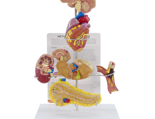 Metabolic Syndrome Mini Organ Anatomy Model Set_main