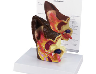 Canine Ear Model with Normal & Abnormal Comparison_main