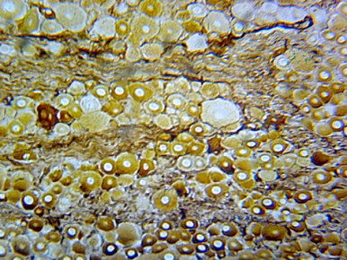 Prepared Microscope Slide, Basal Ganglion, Mammalian; Section