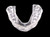 LiteBITE Mouthguard for Basketball, also hockey, lacrosse, snowboarding, skiing, skateboarding, rugby, football, and soccer AND BMX Racing WITH Carry Cases! (Available in blue--see separate listing)