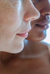 Lysine – Can This Amino Acid Increase Collagen Production AND Treat Cold Sores? Lysine – Can This Amino Acid Increase Collagen Production AND Treat Cold Sores?