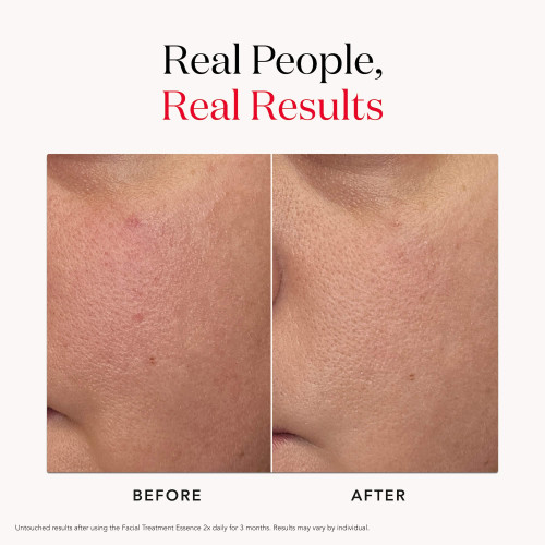 SK-II Facial Treatment Essence: Japanese skincare galactomyces essence and face essence