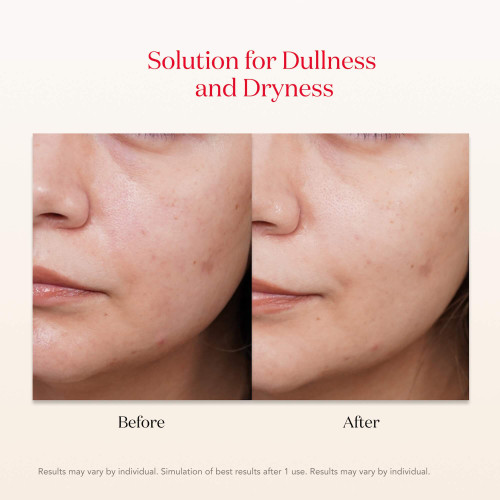 Facial Treatment Mask – Hydrating Sheet Mask for Radiance | SK‑II US
