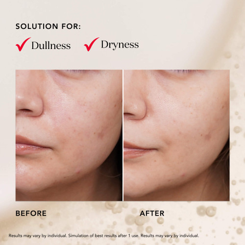 SK-II Facial Treatment Mask: Skin care sheet serum mask for dullness, dryness, and uneven skin tone