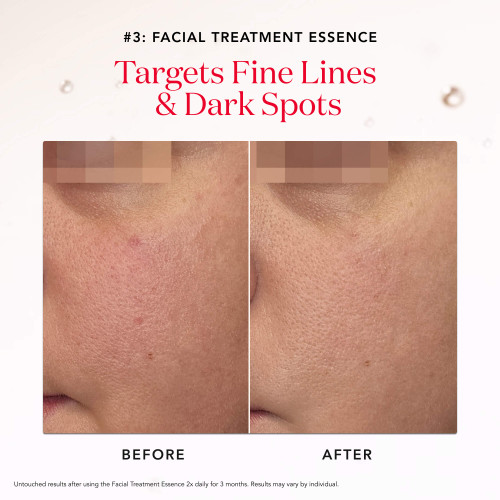 After & Before Facial Treatment Essence 