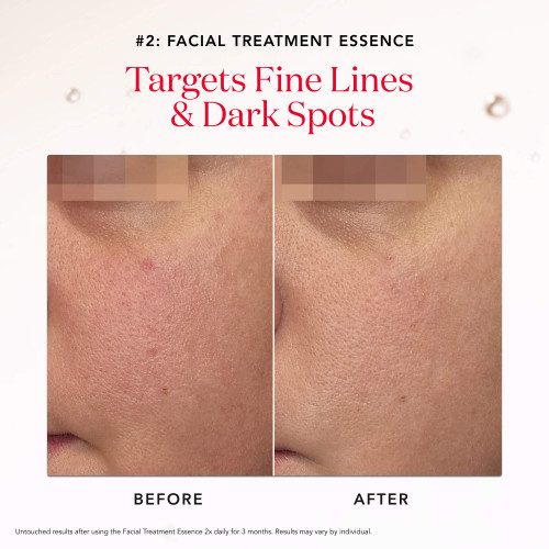 PITERA™ Youth Essentials Kit - 3 Step Skincare Routine | SK-II US
