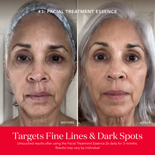 PITERA™ Anti-Aging Set: Best Skincare Kit | SK-II US