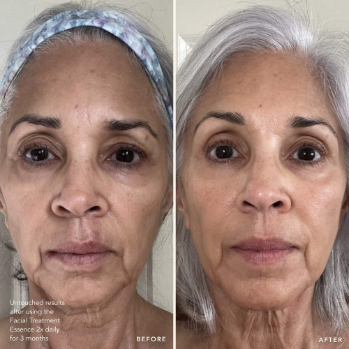Glow Up Duo - Skincare Set for Youthful Skin | SK-II US