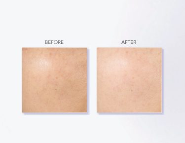  GenOptics InfinitAura Serum banner 2