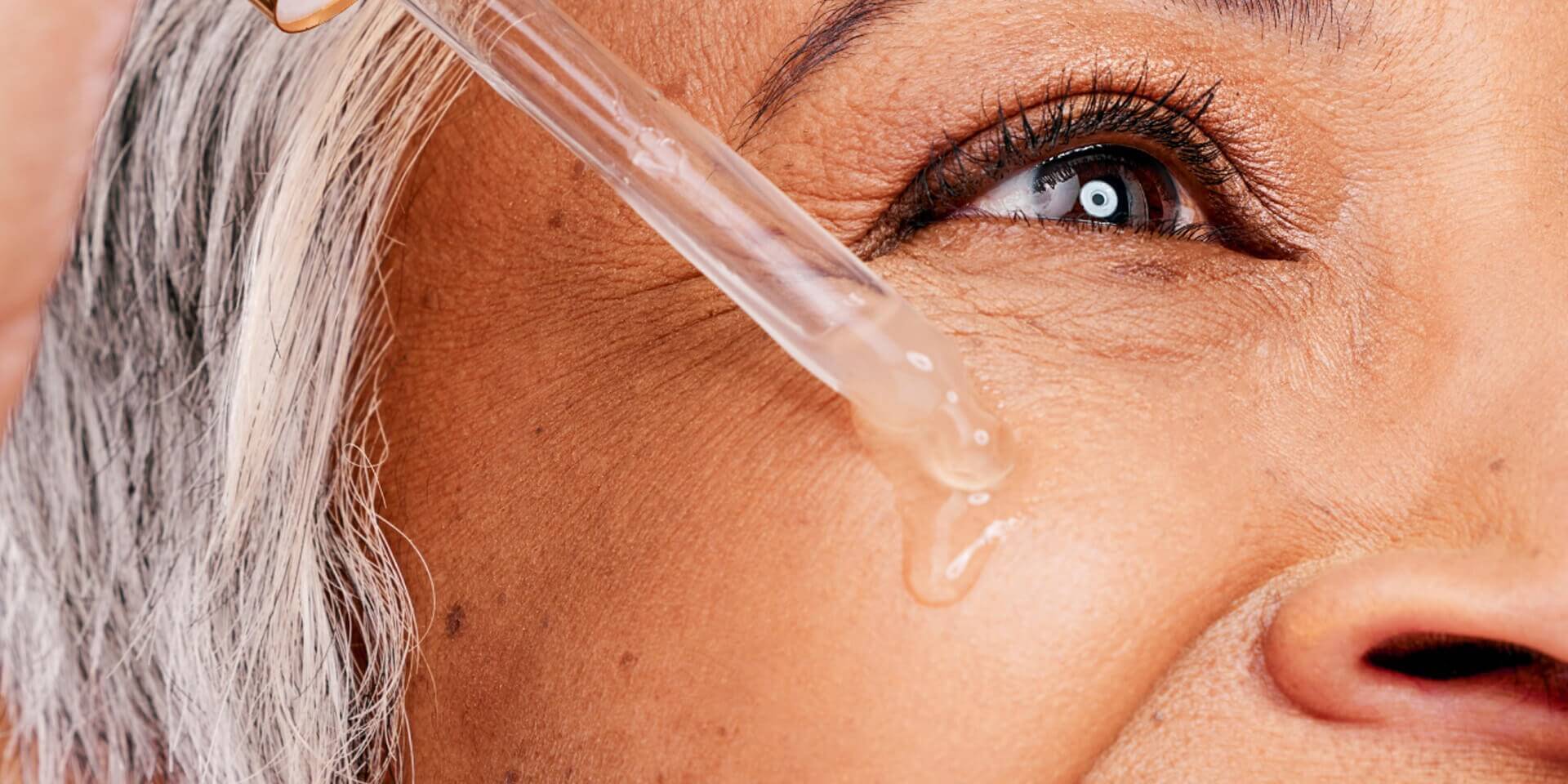 Dark Circles & How to Treat Them | SK‑II US