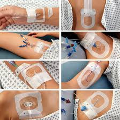 3M™ Tegaderm™ IV Advanced Securement Dressings (5 x 5.7 cm) (Pack of 100)