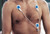 Ambu® BlueSensor SP