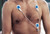 Ambu® BlueSensor SP