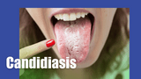 ​What is Candida Albicans?