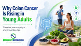 Why Colon Cancer Is Rising in Young Adults: Theories, Warning Signs, and Prevention Tips