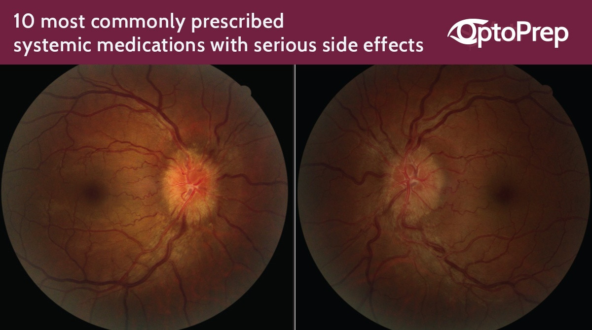 Awareness of Medications that have Ocular Side Effects