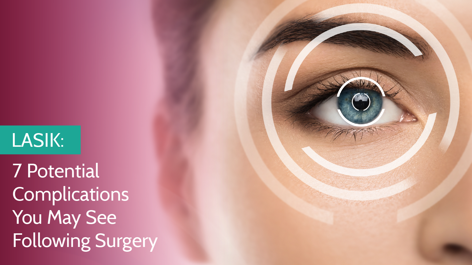 Co-Managing LASIK: 7 Potential Complications You May See Following Surgery