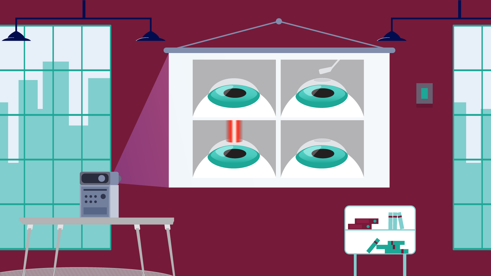 Tips for Talking to Your Patients About PRK Surgery