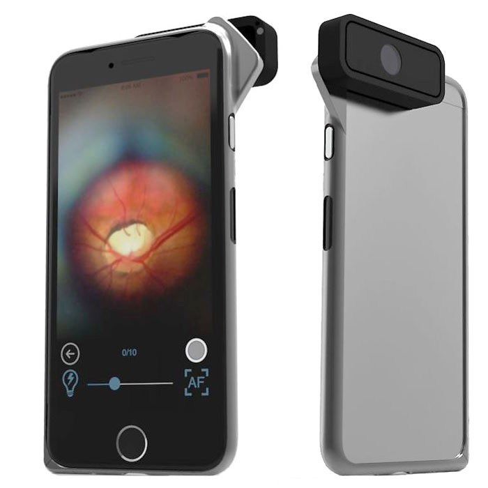 D-EYE Smartphone-based Retinal Imaging System