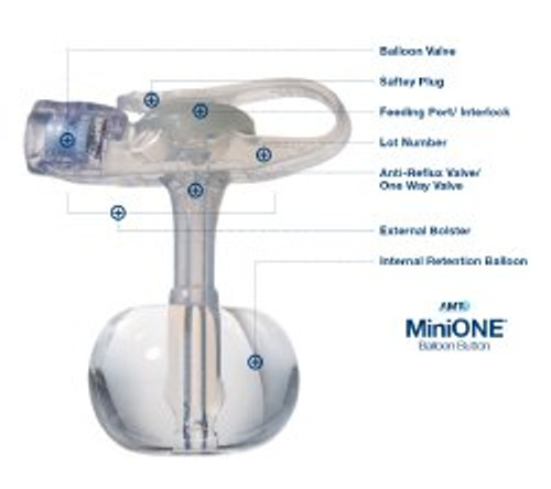Applied Medical Tech M1-5-1212-I - Low Profile Balloon Button Gastrostomy Tube MiniONE® 12 Fr. 1.2 cm Tube Silicone Sterile