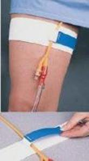 Bird & Cronin 08148214 - Leg Strap Cath-Mate® II Stretches to fit Up to 26 Inch Thigh, Hook and Loop Closure