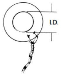 Olympus America Inc 70241014 - Ear Ventilation Tube Collar Button 1.5 mm Ultrasil Blue