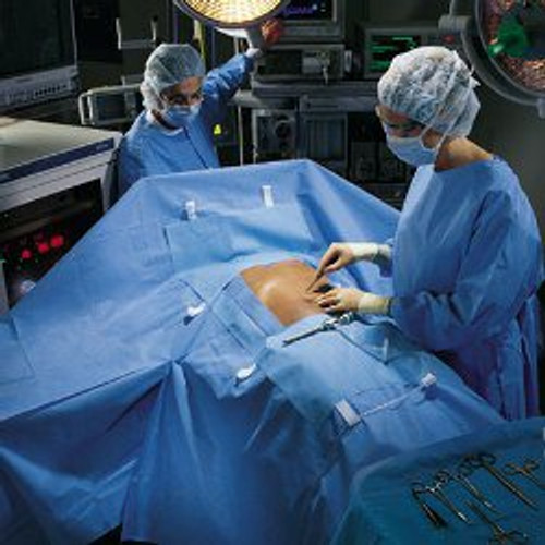 O&M Halyard Inc 89233 - Abdominal Drape Laparoscopic / Abdominal Drape 100 W X 76 W X 124 L Inch Sterile O&M Halyard Inc 89233 - Abdominal Drape Laparoscopic / Abdominal Drape 100 W X 76 W X 124 L Inch Sterile