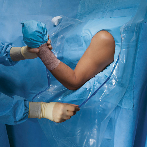O&M Halyard Inc 89070 - Orthopedic Drape Shoulder Arthroscopy Drape 160 W X 102 L Inch Sterile O&M Halyard Inc 89070 - Orthopedic Drape Shoulder Arthroscopy Drape 160 W X 102 L Inch Sterile