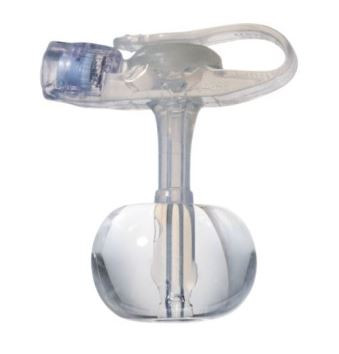 MiniONE Balloon Button Kit with ENFit, 14 Fr x 0.8 cm