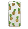 Case for Coque Huawei P10 Case Silicone Cover 5.1 Ultrathin Soft TPU Full Protective Phone Back Cover Case Etui for Huawei P10