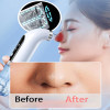 Blackhead Remover Nose Face Deep Cleaner Pore Acne Pimple Removal