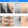 Maglev Plasma Pen Eyelid Lifting Pen Laser Plasma Tattoo Freckle Dark Spot Remover Wart Removal Beauty Machine With 3pcs Needle