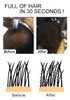 Sevich Anti Hair Loss/Growth Powder