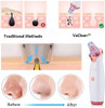 Blackhead Removal Tool