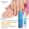 Fungal Nail Treatment Pen Anti Infection Gel Foot Toe Nail