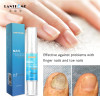 Fungal Nail Treatment Pen Anti Infection Gel Foot Toe Nail