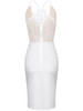 Casual Exquisite Spaghetti Strap Decorative Lace Bodycon Dress