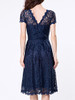 Casual Decorative Buttons Hollow Out Sexy Lace Skater Dress