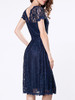 Casual Decorative Buttons Hollow Out Sexy Lace Skater Dress