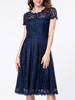 Casual Decorative Buttons Hollow Out Sexy Lace Skater Dress