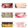 Stain-Free Teeth Whitener Toothpaste