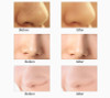 Electric Acne Pore Cleaner Blackhead Vacuum