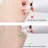 Electric blackhead acne removal blackhead vacuum cleaner E-01-01